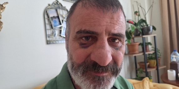Ankara’da tekel bayi işletmecisini darbeden 2 şüpheli yakalandı