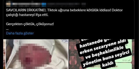 İstanbul – Sosyal medyada yayılan özel hastanede bebeklere kötü muamele iddialarıyla ilgili inceleme başlatıldı