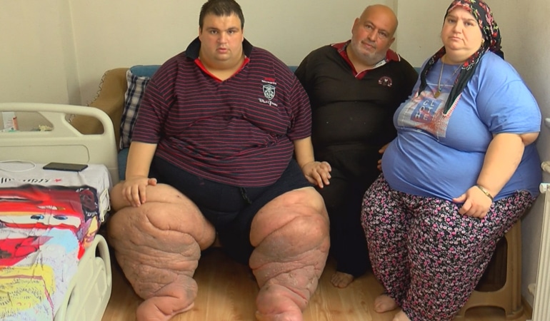 İstanbul – 270 kilo Mehmet: 15 aydır evden çıkamıyorum, yardım edin