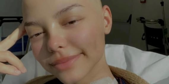 Elif’in lenf kanseri ile sıra dışı mücadelesi